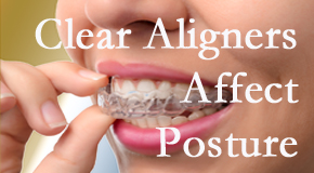 Clear aligners influence posture which St Peters chiropractic helps.