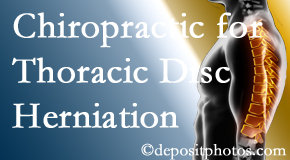 Old Mill Chiropractic diagnoses and manages thoracic disc herniation pain and relieves its symptoms like unexplained abdominal pain or other gastrointestinal issues. 