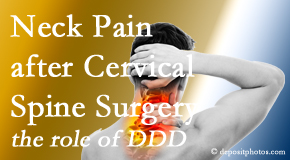 Old Mill Chiropractic offers gentle treatment for neck pain after neck surgery.