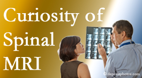 St Peters MRIs for spinal stenosis may be revealing…or confusing.