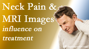 Old Mill Chiropractic considers MRI findings like Modic Changes when setting up a neck pain relieving treatment plan.