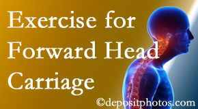 St Peters chiropractic treatment of forward head carriage is two-fold: manipulation and exercise.